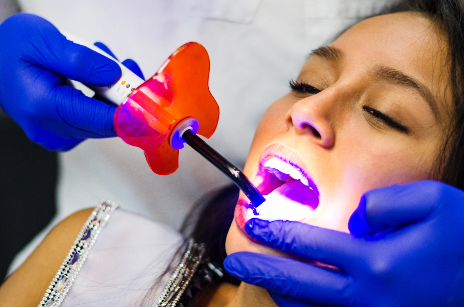 The Benefits of Professional Teeth Whitening