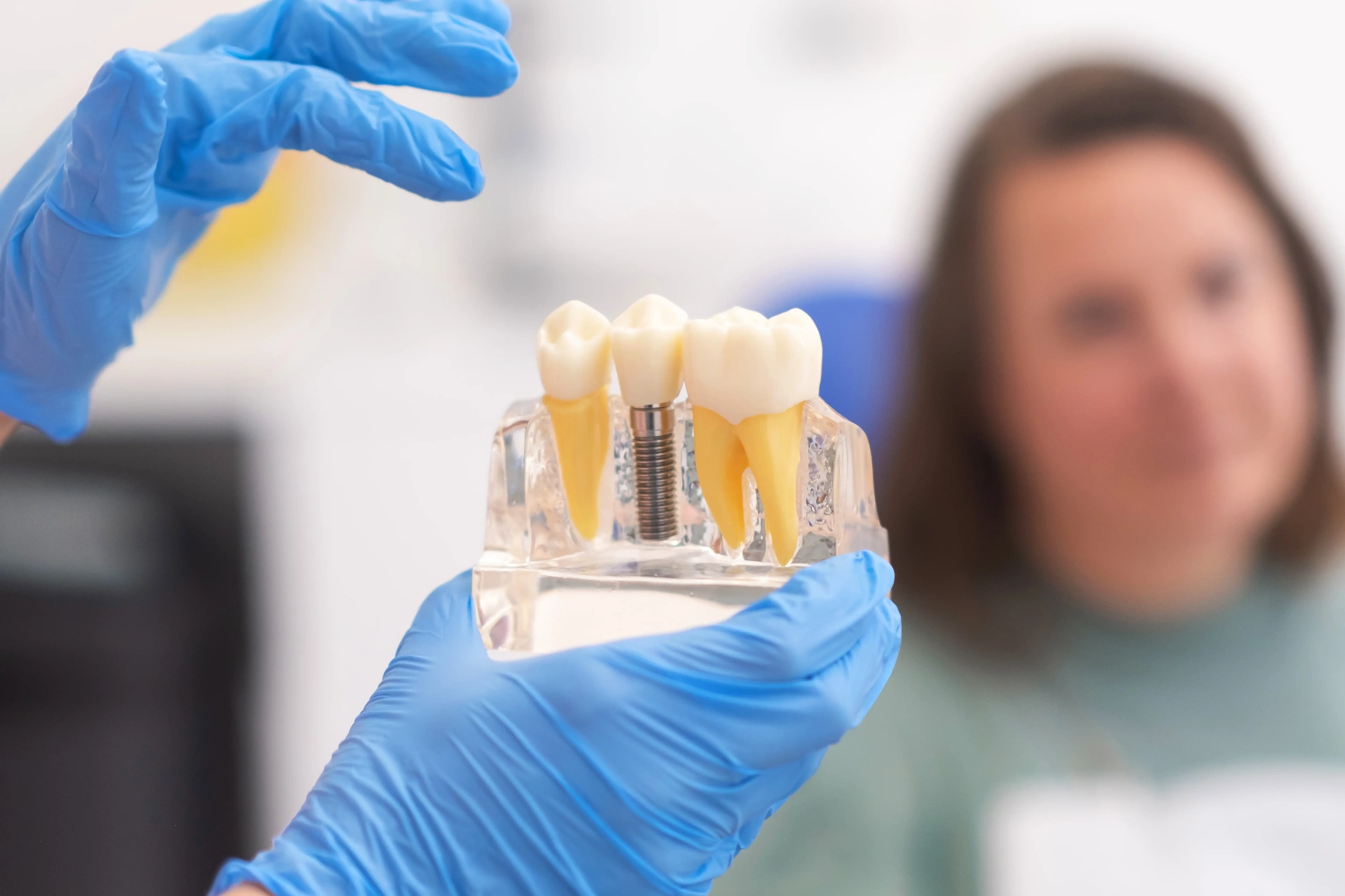 Dental Implants at Fieldgate Dentistry